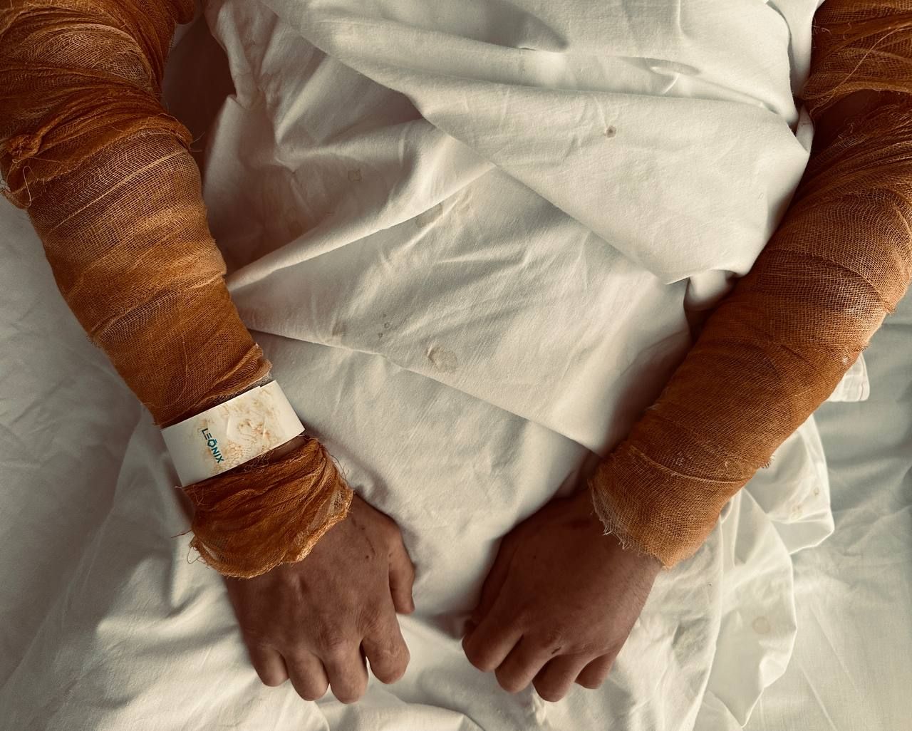 Двое мужчин получили серьезные ожоги паром в одной из общественных бань Казани