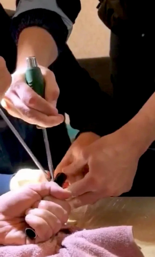 В Казани спасатели достали палец мальчика, застрявший в ножке стула