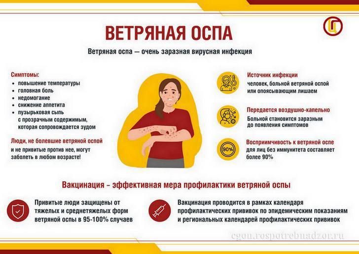 Роспотребнадзор объяснил татарстанцам, почему надо прививаться от ветрянки