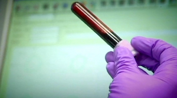 fd340edcd8169d21ca77ed7d08e62449