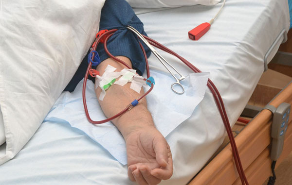 гемодиализ