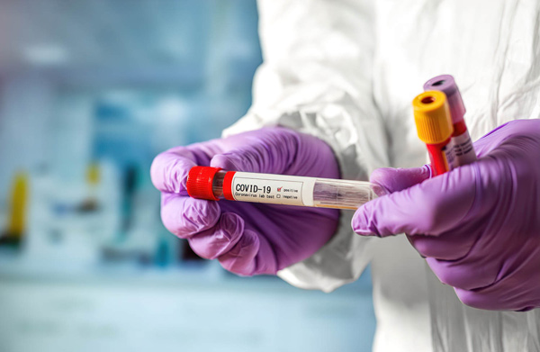 тест-на-коронавирус