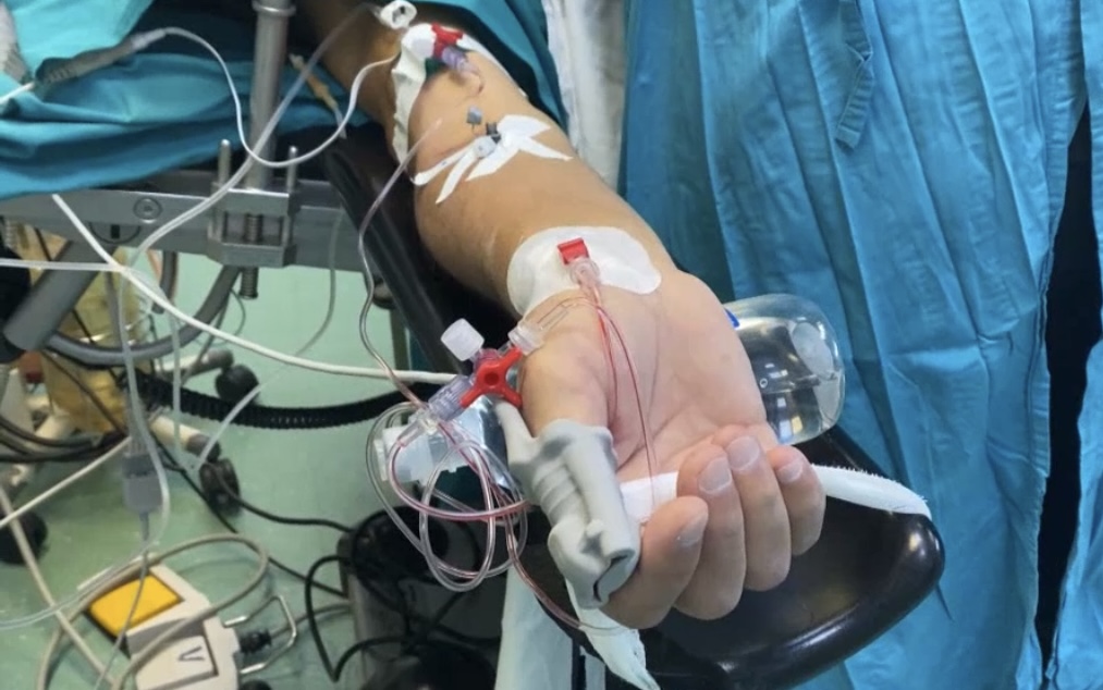 В больнице Казани провели операцию по пересадке почек двум родственникам от одного донора