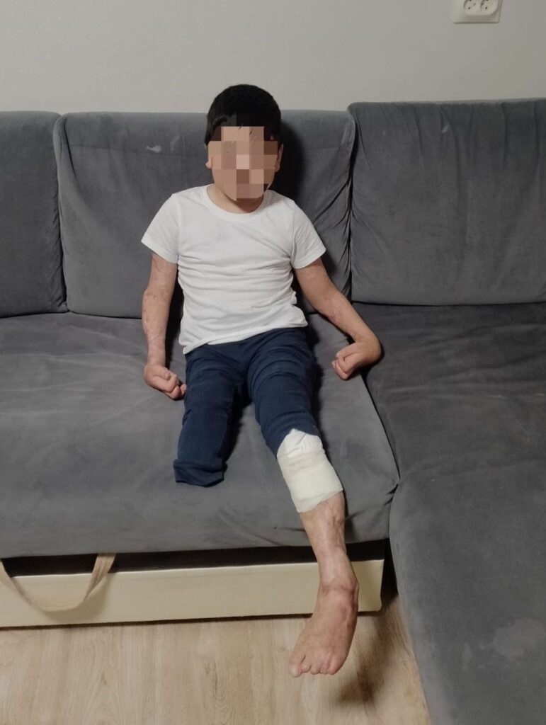 15 млн за вред: отец ребенка, оставшегося без ноги после лечения в ДРКБ, требует компенсацию