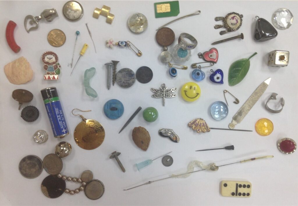 «Как страусы, глотают все»: врач ДРКБ Татарстана – об опасных находках в животах у детей