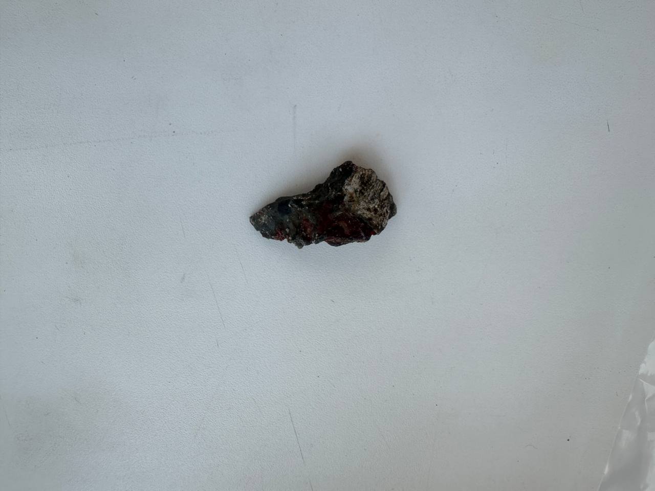 Врачи РКБ удалили осколок из щеки бугульминца, раненного при боевом задании на СВО