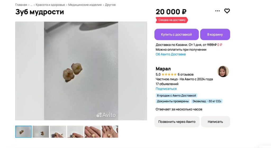 Зубы мудрости, чипсина-«сердце» и «бабий магнит»: какие диковины продают по объявлениям в Казани