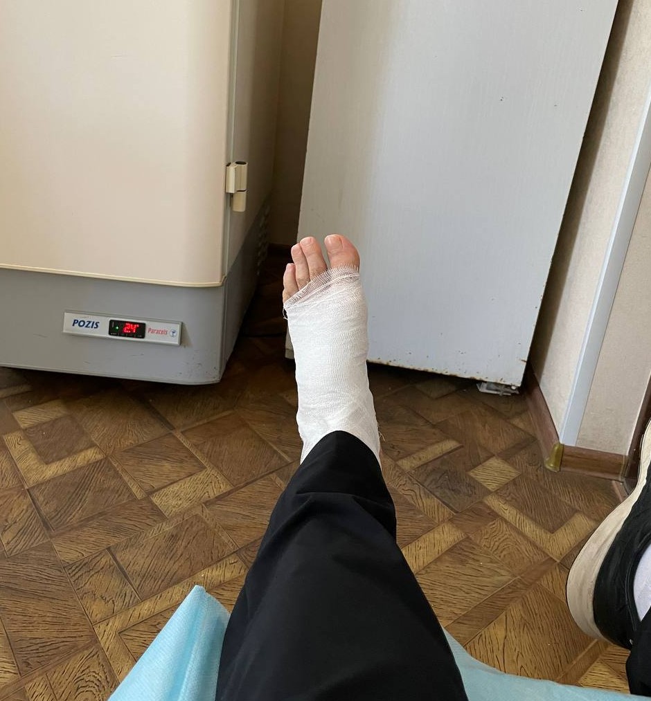 Глава Бугульминского района наступил на гвоздь во время обхода и попал в больницу